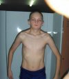 Wrzody pod pachami ma biedaczysko