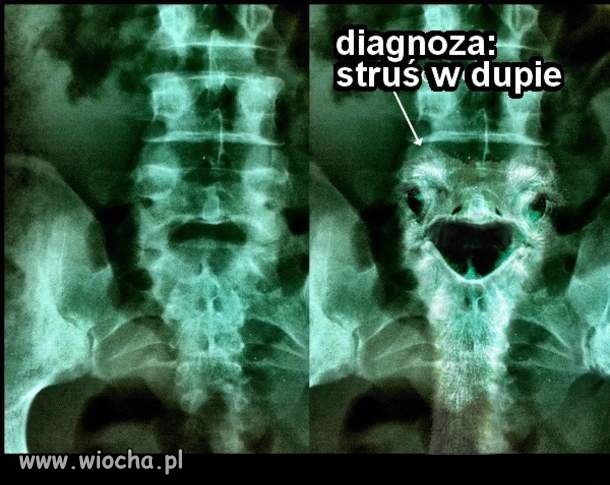 Diagnoza