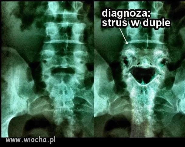 Diagnoza