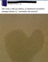 Beka z patologi 