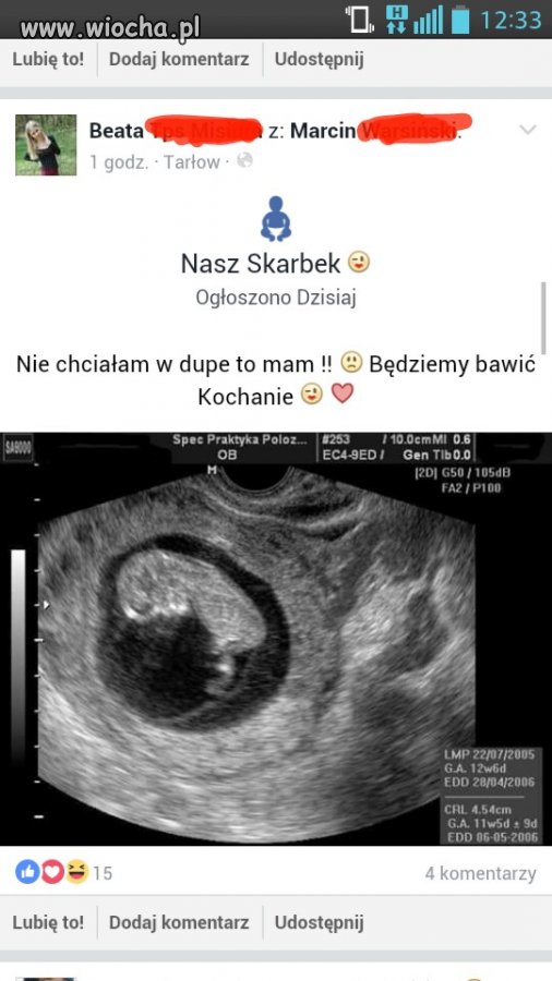 On chciał w du@e