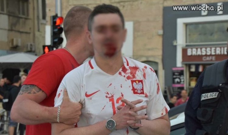 Albańczycy zaatakowali polskich kibiców.
