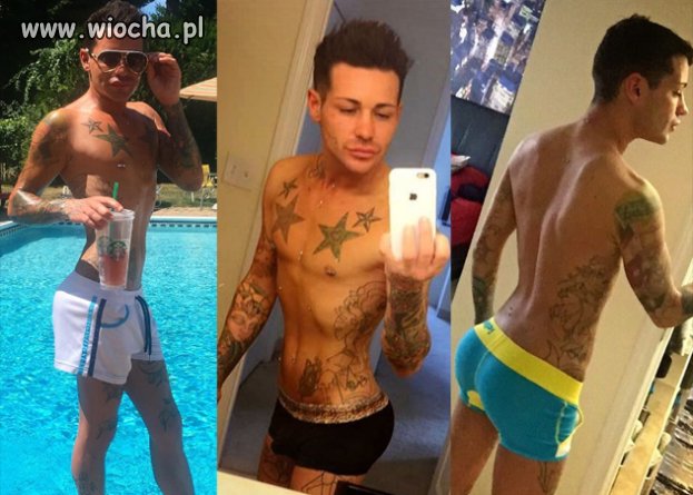  26-latek trzykrotnie powiększył sobie pośladki! 