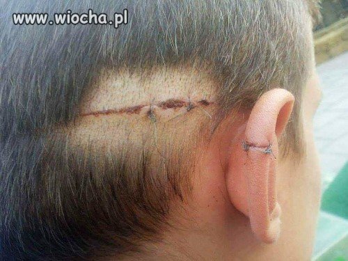"uchodźca" pociął 16-latka, po tym, jak..