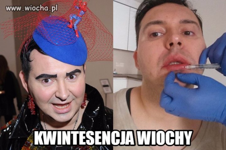 Niezłe stroje, botoks. Dla mnie gość to