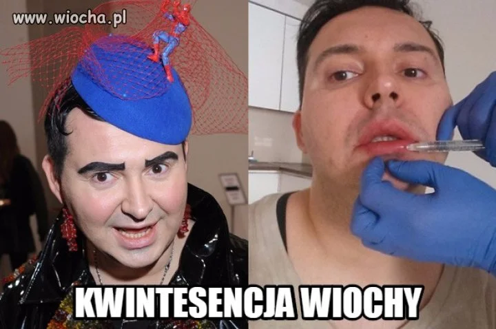 Niezłe stroje, botoks. Dla mnie gość to