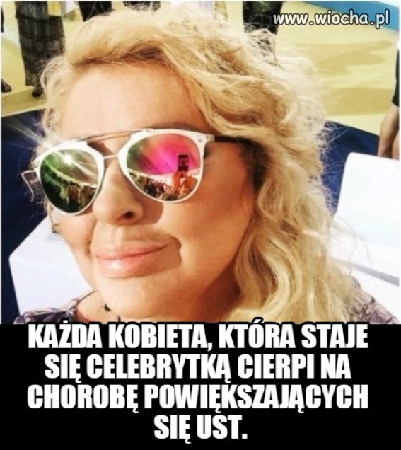 Celebryta = usta jak kaczka.