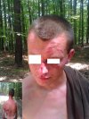 Tak się kończy spacer do lasu na Leśnej Górze 7