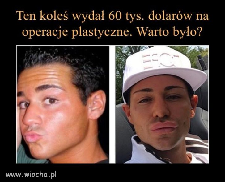 No jednym słowem szał.