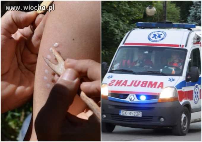 Mazowsze: Kobieta zginęła w wyniku "ceremoni kambo"