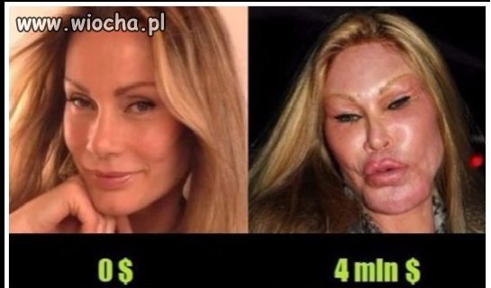 Jeżeli ktoś ci mówi że wyglądasz jak 4 mln $