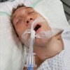 Facet po uderzeniu siekierą w głowę w Dusseldorfie