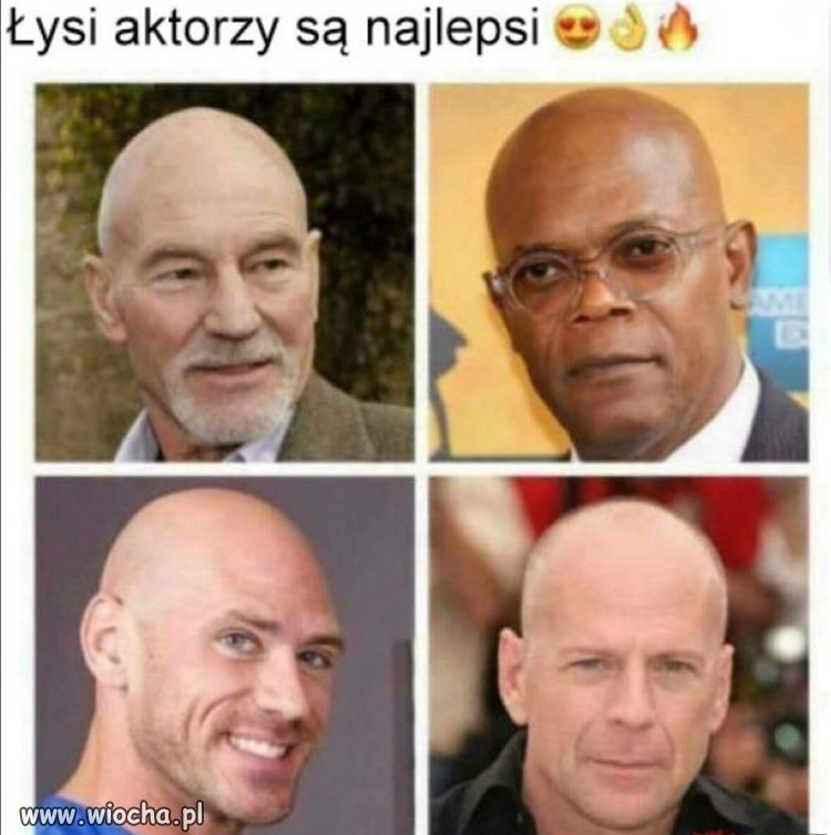 Łysienie to nie tragedia