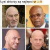 Łysienie to nie tragedia