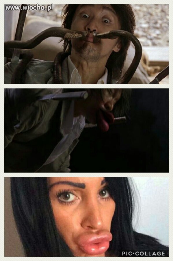 Kung fu botox