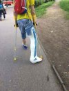 Sebiks i jego gips