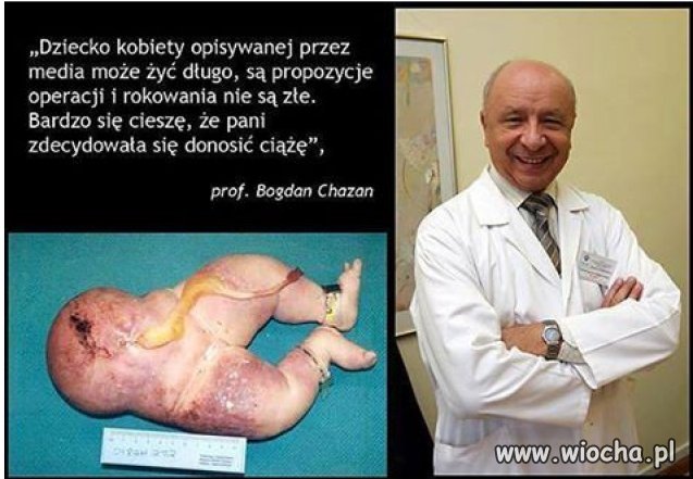 Po urodzeniu takiego dziecka