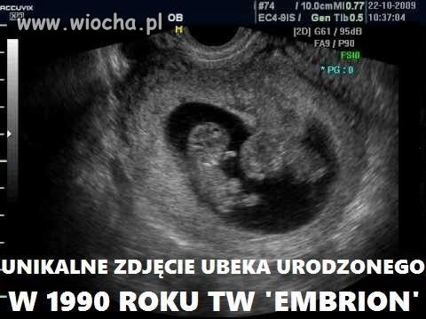 Unikalne