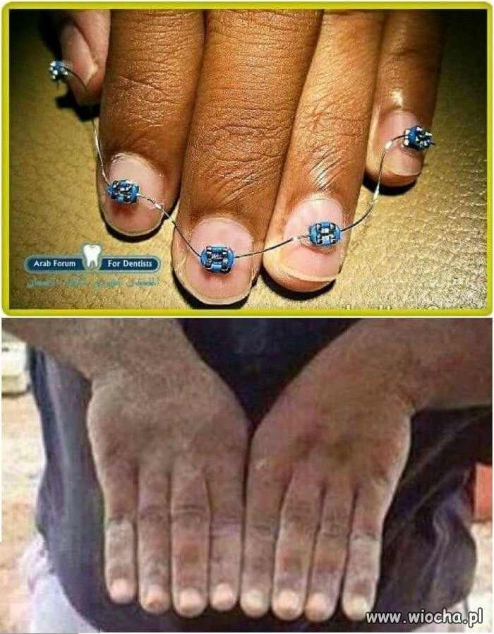 Efekt noszenia