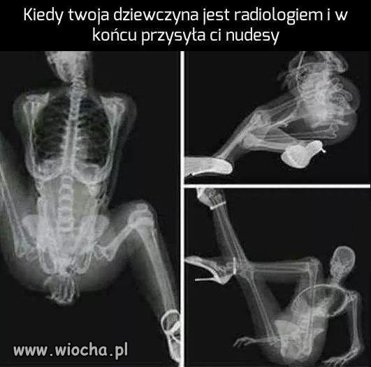 Gorące fotki