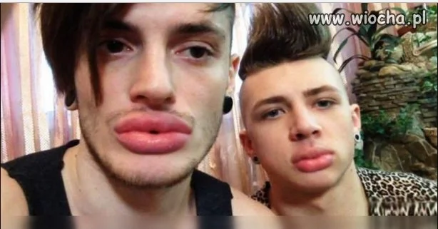 Dzióbaski 