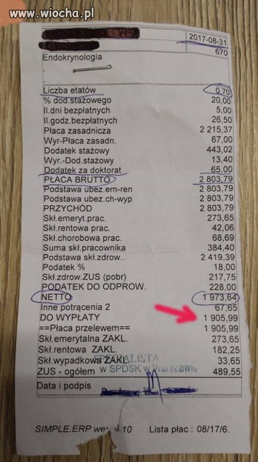 Prawda o zarobkach rezydentów