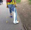 Markowy gips nie na NFZ