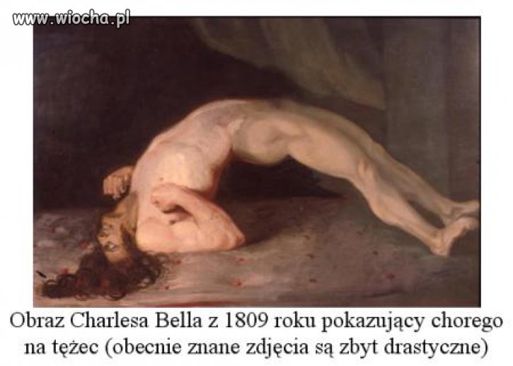 Tężec - wiesz co to Antyszcepionkowcu? 