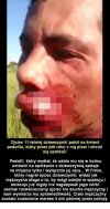 Działanie w stanie wyższej konieczności. 