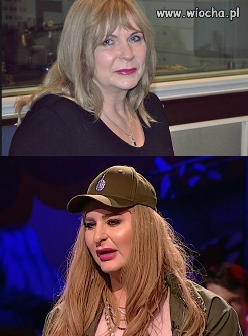 Przed operacją  i po
