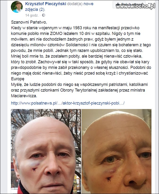 Aktor pobity za czerwoną kurtkę ?