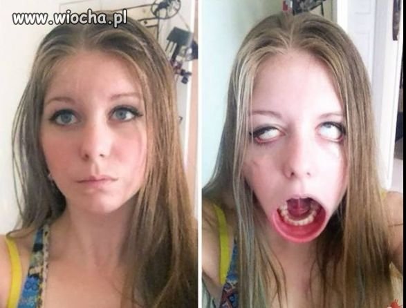 Powiedz Aaaa!