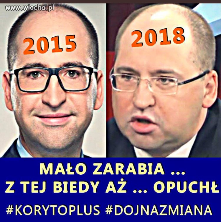 Opuchlizna głodowa