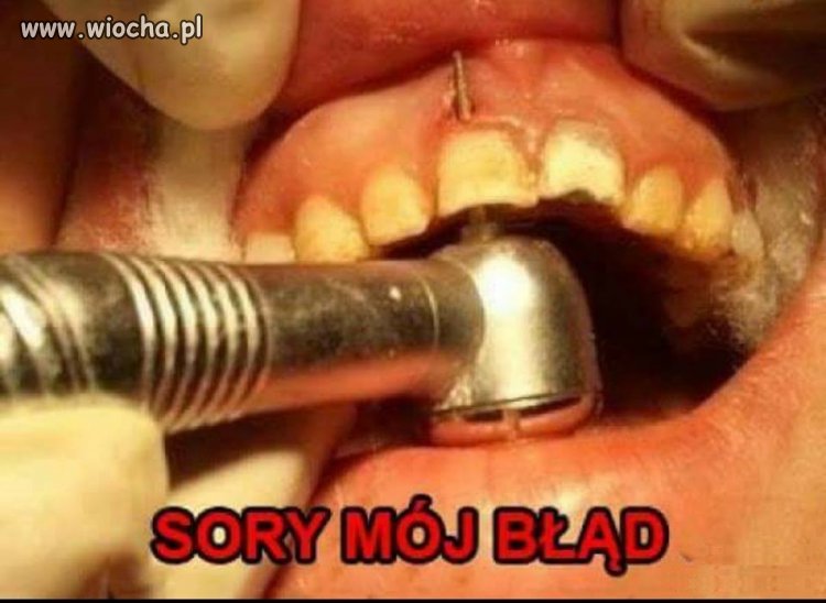 To musiało k... boleć 