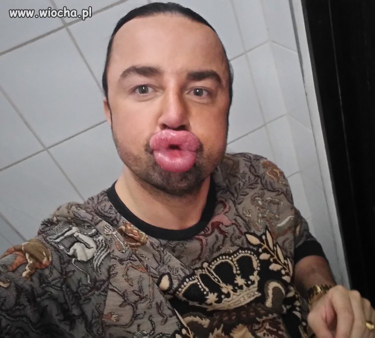 Glonojad 