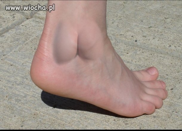 Pięta z du.ą na boku 