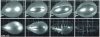 Polska reprezentacja na MS