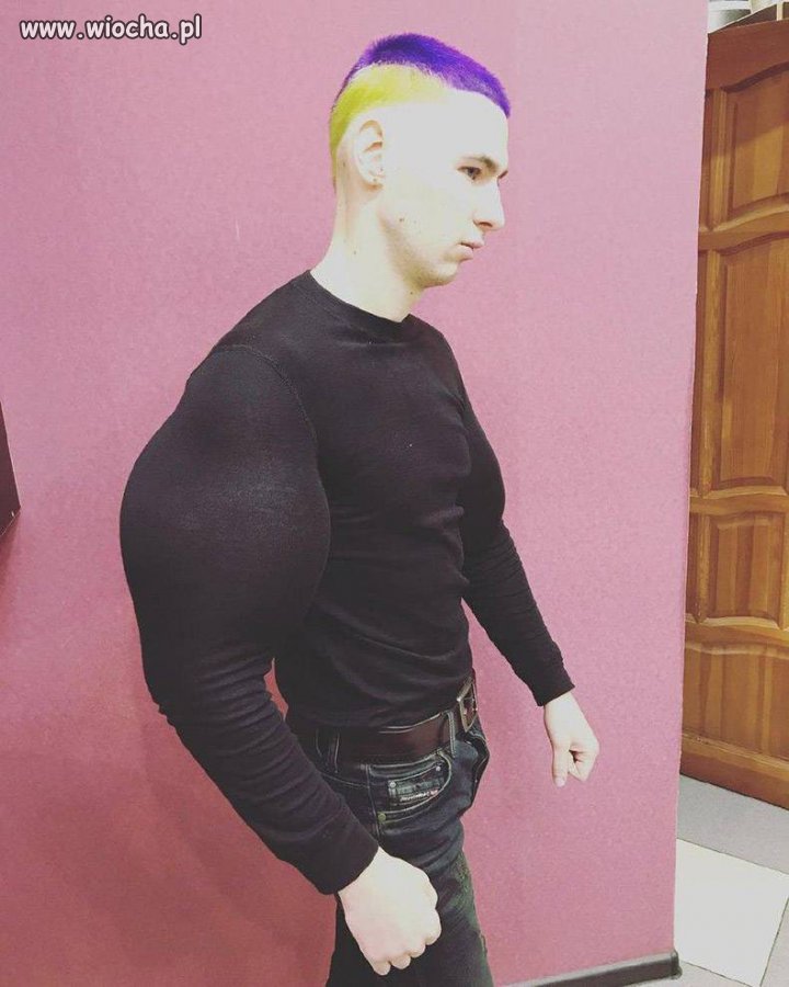 Syntholowy