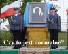 Czy to normalne