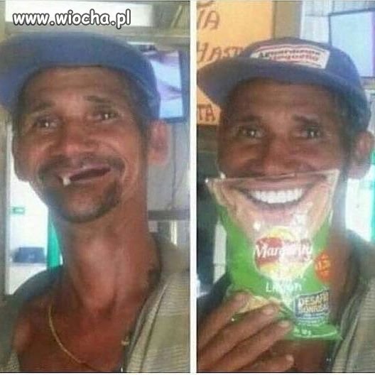 Piękny uśmiech z chipsami