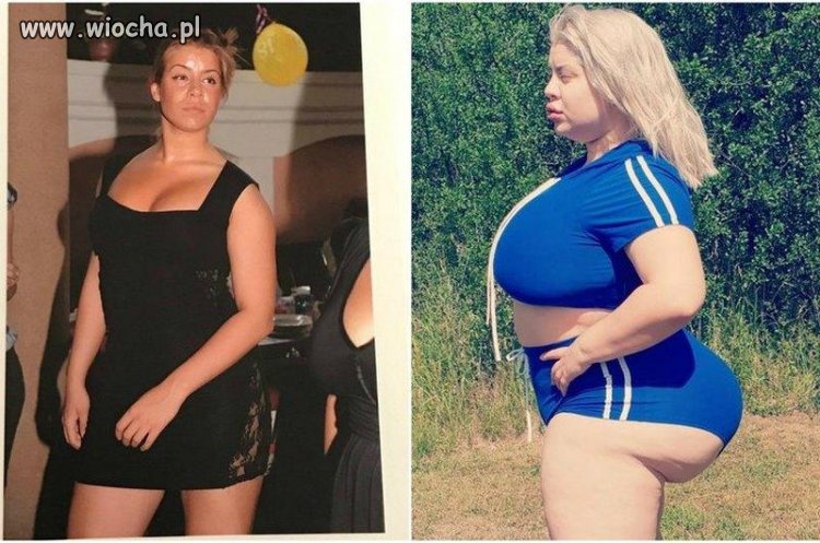 Przed i po "upiększeniu"