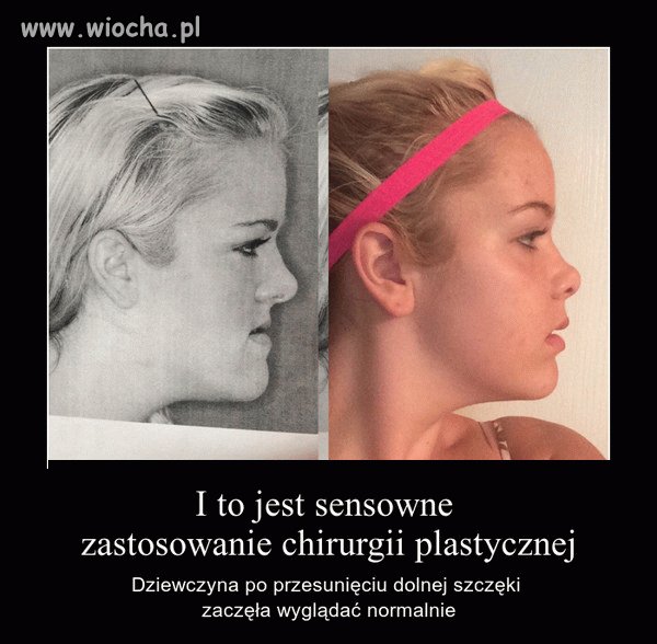 No niestety wiele osób dalej tego nie rozumie