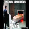 Tomografia komputerowa na NFZ