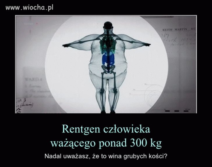 Szach i Mat