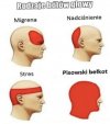 Rodzaje bólów głowy