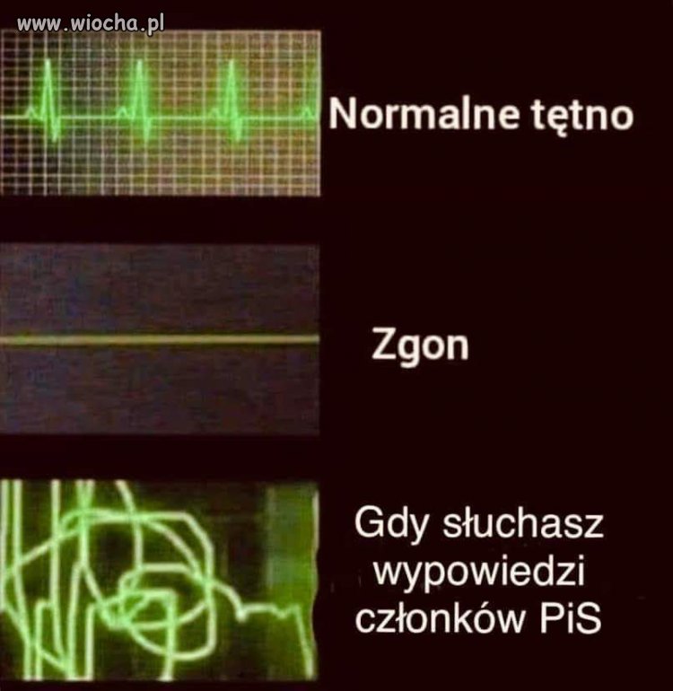 Normalne tętno