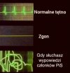 Normalne tętno