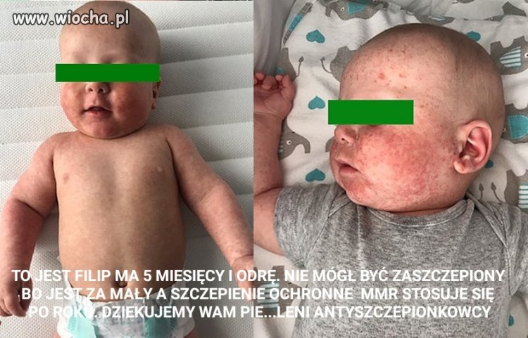 Antyszczepionkowcy zagrażają waszym dzieciom
