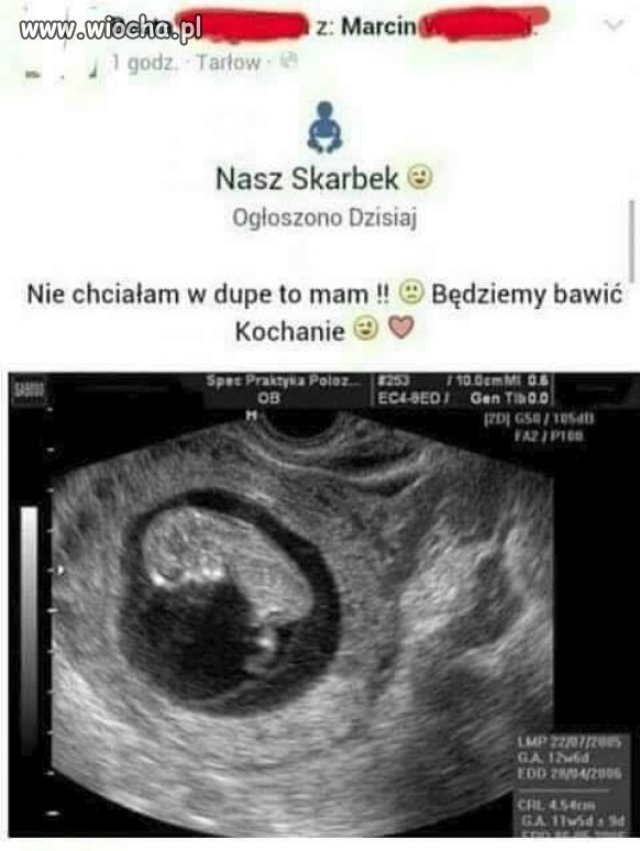 Nie chciała w d*pę to teraz ma...