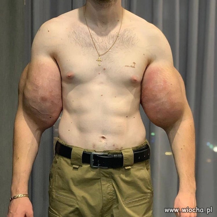 Bicki na syntholu